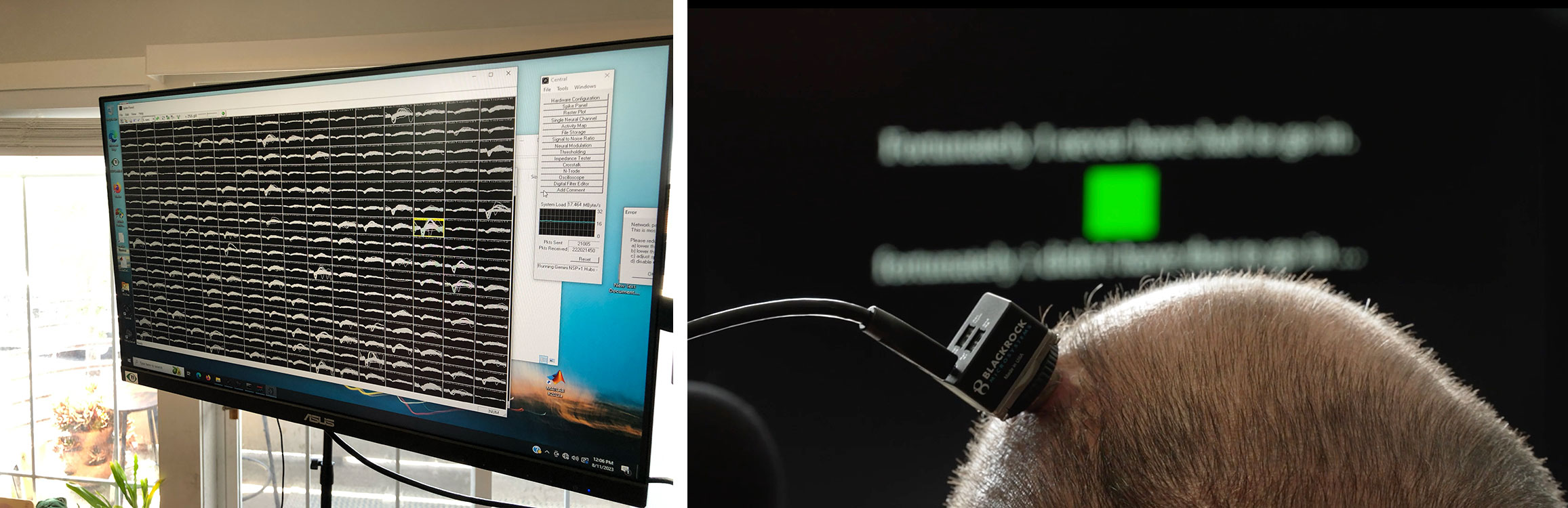 Recordings of brainwaves on a computer screen, next to a photo showing the point on a participant's head where the computer interface exits.