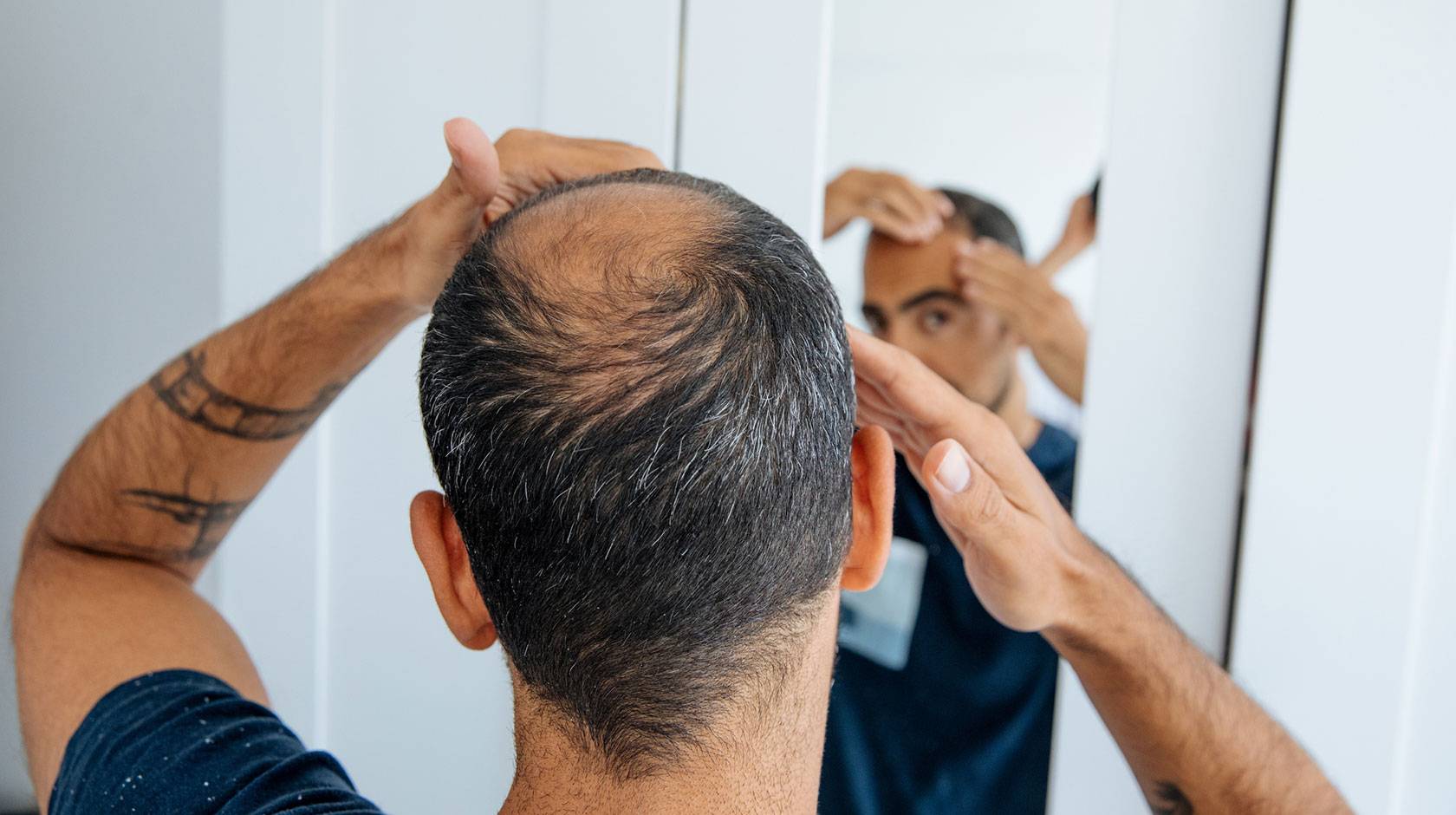 A man with thinning hair on the back and top of his head looks in the mirror, hands on his head.