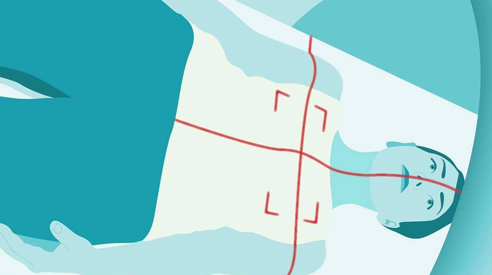 Flat-style, teal-toned illustration of a woman in a CT scanner