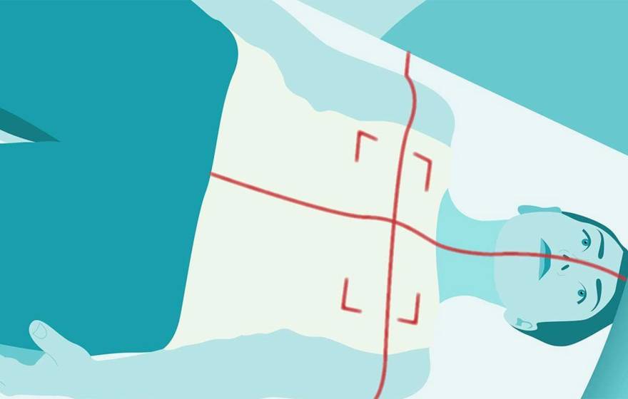 Flat-style, teal-toned illustration of a woman in a CT scanner