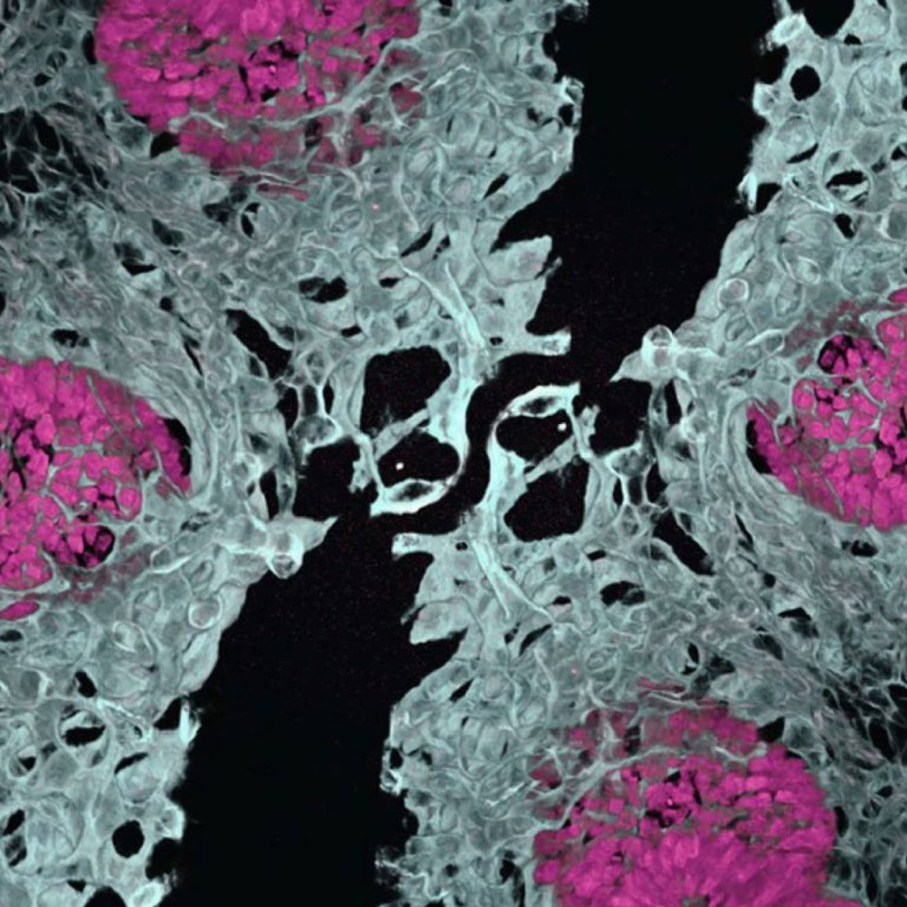 A microscope slide showing delicate gray structures interspersed with pink nodules, against a dark ground