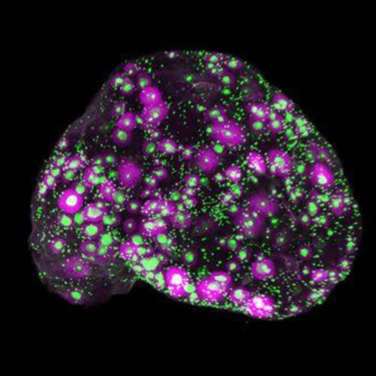A 3D view of a whole mouse ovary, with every egg marked in green and the growing egg follicles in magenta.